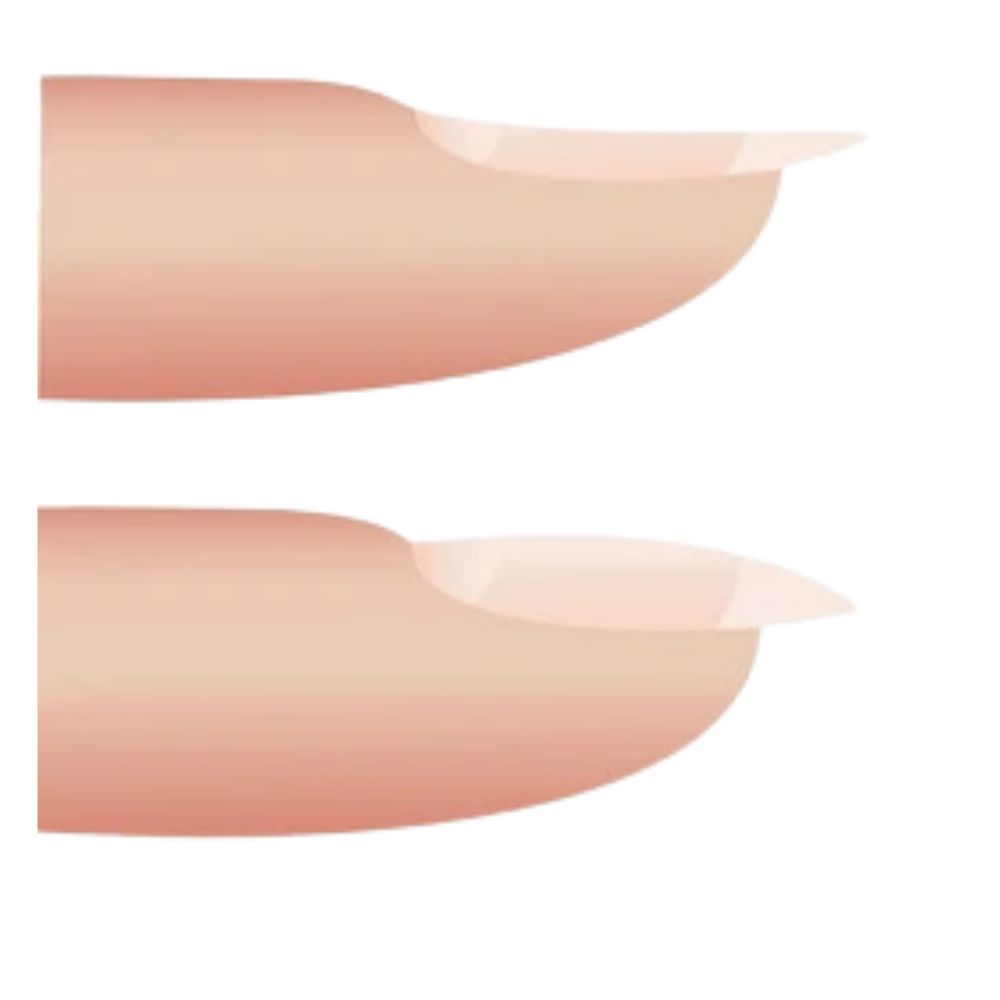 nail plate tension zones