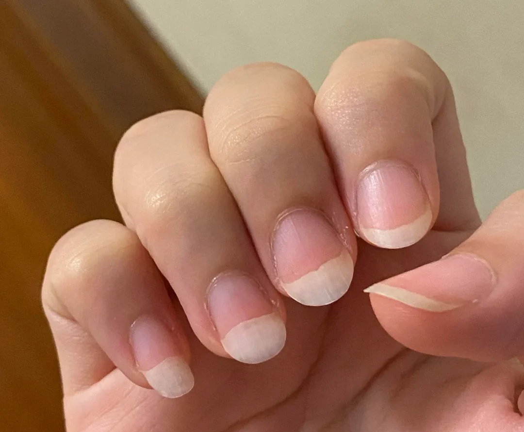 nails thickness - thickness mapping